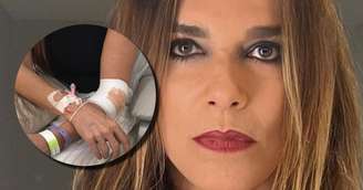 A atriz Mara Carvalho em selfie do Instagram e, no detalhe, os braços com curativos em foto postada por seu filho Bruno Fagundes