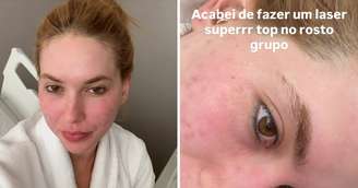 Médico explicou que processo de recuperação leva até 30 dias