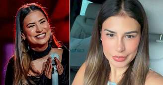 O novo visual de Simone Mendes: cantora mostra detalhe de intervenção no nariz e manda recado aos seguidores