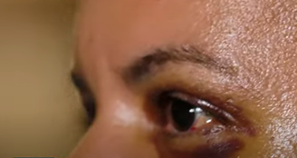 Juliana foi agredida com 61 socos por seu então namorado