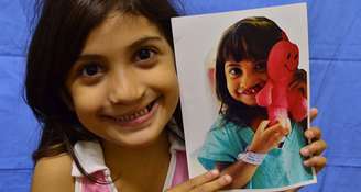 O projeto Operação Sorriso opera gratuitamente em diversas regiões do Brasil crianças e adultos com fissura labiopalatina