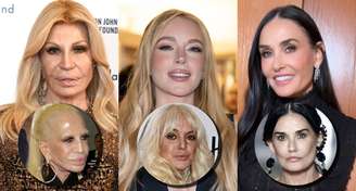 O antes e depois de Donatella Versace, Lindsay Lohan e Demi Moore: milhões gastos para corrigir procedimentos desastrosos e renovar a aparência