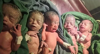 Médico revelou que os recém-nascidos pesavam entre 1,3 kg e 1,4 kg no momento do parto, realizado por cesariana