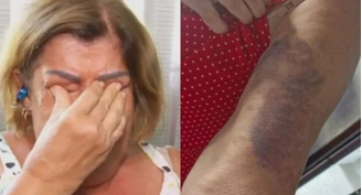 Celia Regina exibe marcas das agressões