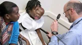 Haitiana tem tumor de dois quilos removidos do rosto