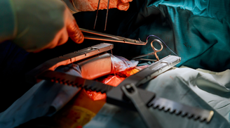 Cirurgia do coração