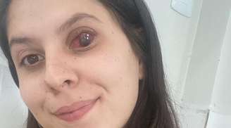 Esther luta contra o câncer: ajude a salvar sua visão e sua vida!