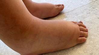 A luta de Dai: arrecadação de fundos para cirurgia urgente