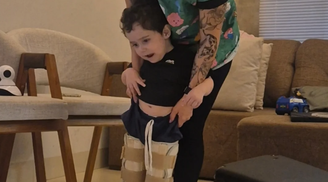Criança com AME recebe medicamento que custou milhões, mas família enfrenta nova batalha