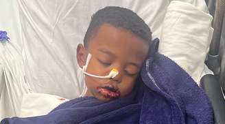 A luta de uma mãe para salvar Enzo Gabriel da Síndrome de Stevens-Johnson