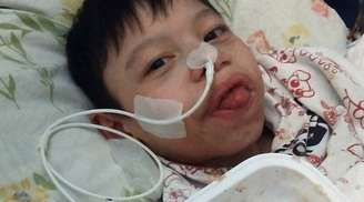 Uma cirurgia para Nathan: esperança em meio à luta contra a desnutrição