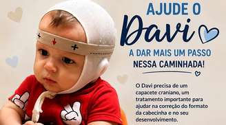 Uma esperança para Davi: como você pode ajudar no tratamento de plagiocefalia