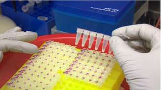 Mais de 600 amostras de sangue de pacientes da Guiné serão analisadas