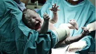 Brasil está em 77º lugar no ranking com 179 países sobre bem-estar materno 