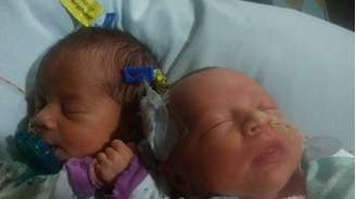 As irmãs gêmeas Darla (esq.) e Dalanie nasceram em 17 de junho