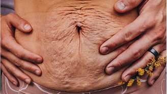 Cody, marido de Hayley, comentou sobre as marcas pós-parto de sua mulher: 'Tatuagens, cicatrizes, cirurgias, pêlos faciais idiotas ou uma barriga pós-parto, honestamente... quem se importa?'