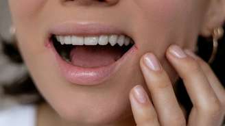 Diversos fatores sugerem uma forte correlação entre a presença do vírus herpes simplex no cérebro e os marcadores clássicos do Alzheimer, mas não prova que eles sejam a causa da doença. MarijaBazarova/Shutterstock