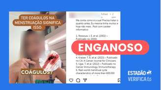 A presença de coágulos está relacionada a um maior fluxo menstrual.