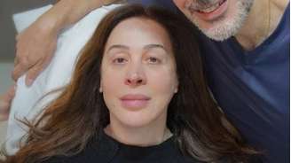Claudia Raia colocou fios de colágeno para melhorar a flacidez do rosto