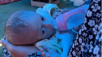 Siwar precisa de uma fórmula especial de leite devido a uma reação alérgica