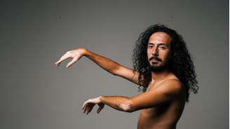 Giovanni se expressa por meio da arte e leva o vitiligo para novos espaços