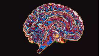 A neurociência começou a explorar como o poder político e o contexto institucional influenciam a atividade cerebral associada a decisões corruptas ou imorais.