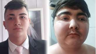 Duas fotos do adolescente Gustavo de Oliveira: a primeira, à esquerda, é de março de 2024; a segunda, à direita, é de dezembro de 2025