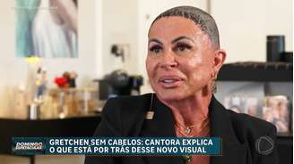 Gretchen raspou o cabelo e ficou 'careca' para realizar transplante capilar devido à sua alopecia; cantora deu entrevista à Record TV