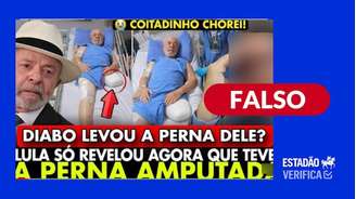 Informação falsa sobre amputação de perna do presidente Lula circula nas redes sociais