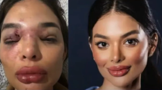 Giulia Kos foi agredida pelo marido