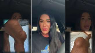 Gracyanne Barbosa mostra joelho inchado durante ensaios da ‘Dança dos Famosos’
