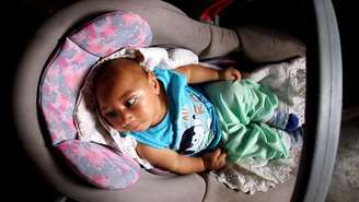 Banhos de balde ajudam a acalmar José Wesley, que é agitado como outros bebês com casos recentes de microcefalia, associada ao zika vírus 