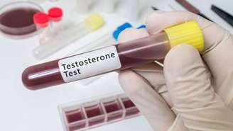 O uso do suplemento de testosterona só é recomendado se houver um diagnóstico médico