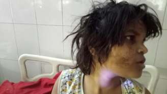 Garota emite grunhidos, anda de quatro, usando braços e pernas, e foi comparada a personagem Mogli