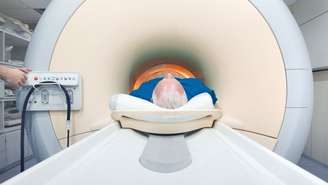 Os testes de ressonância magnética serviriam para reduzir o número de homens que precisa fazer uma biópsia.
