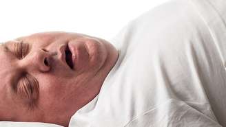 A apneia do sono pode causar ronco alto e respiração ruidosa enquanto a pessoa dorme