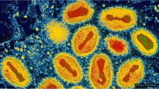 Além do Sars, apenas dois outros vírus foram levados à extinção propositalmente: varíola e peste bovina