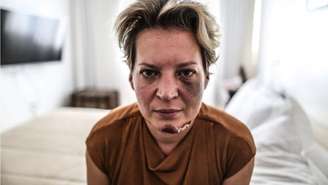 Joice Hasselmann é fotografada com hematomas no rosto em seu apartamento funcional em Brasília