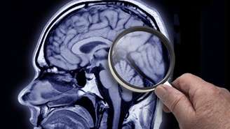 O cérebro humano atual é menor que o dos nossos ancestrais