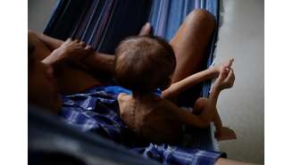 Indígenas yanomami em quadro de desnutrição em Boa Vista, Roraima