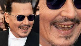 Dentes de Johnny Depp em Cannes chamam atenção da internet