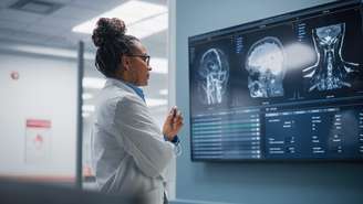 Imagem representa uma médica analisando imagens do cérebro humano