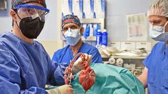 Médicos durante cirurgia de transplante de coração de porco