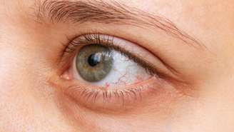 Veja como cuidar dos olhos no tempo seco - Shutterstock
