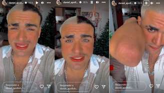 Ator disse ter contraído sarna após usar figurinos na Record e ameaça processar emissora.