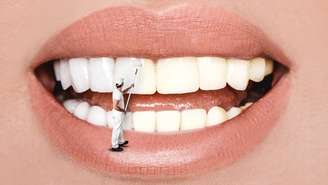 Hábitos que prejudicam os dentes -