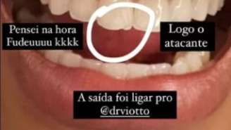 Dente da cantora –