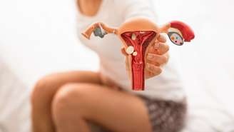 Endometriose afeta mulheres em idade reprodutiva