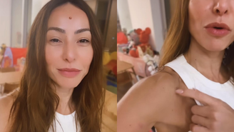 Sabrina Sato mostra machucados causados por fantasias de carnaval