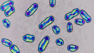 Causada pela bactéria Yersinia pestis, a peste bubônica é tratada atualmente com mais facilidade com os antibióticos modernos